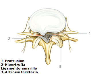 Enfermedades