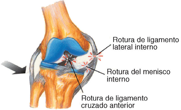 Enfermedades