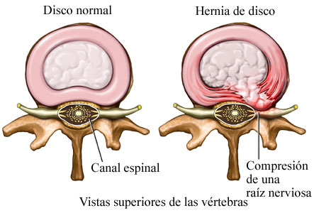 Artículos